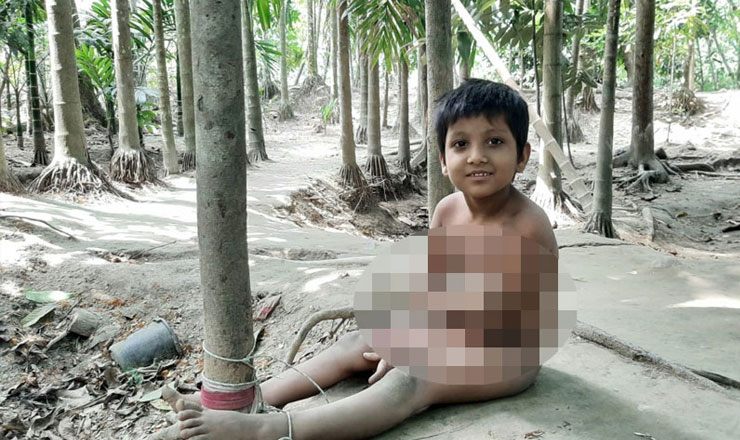গাছের সঙ্গে বাঁধা শিশু কাওছারের জীবন! - the Bengali Times