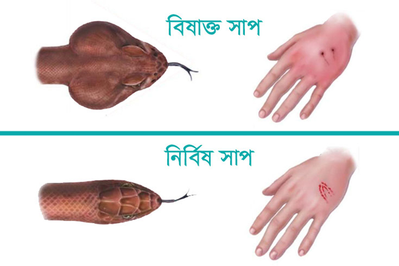 বাংলাদেশের যে ৭ সাপ বিষধর, কামড়ালে যা করবেন - the Bengali Times