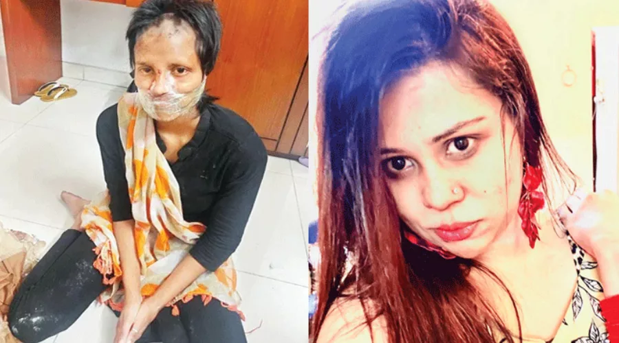 স্কচটেপ দিয়ে মুখ ও সুপারগ্লু দিয়ে আটকে দেয়া হয় হাত, তারপর… - the Bengali Times