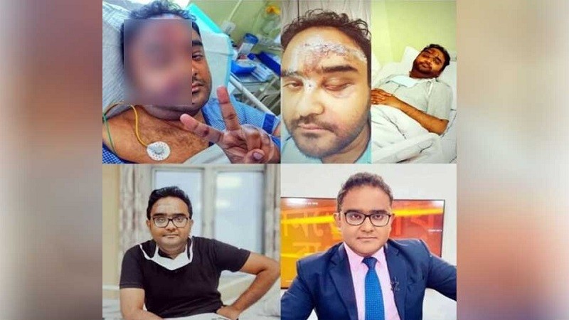 সাংবাদিক ময়ূখের মুখ ফেটে যাওয়া ছবিগুলো নিয়ে যা জানা গেল - the Bengali Times
