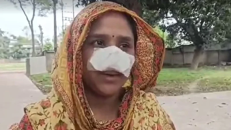 স্ত্রীর নাক সুন্দর, তাই ঘুমন্ত অবস্থায় নাক কামড়ে নিল স্বামী - the Bengali Times স্ত্রীর নাক সুন্দর, তাই ঘুমন্ত অবস্থায় নাক কামড়ে নিল স্বামী - the Bengali Times