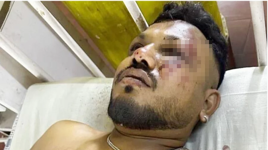 ভারতে বিমান দুর্ঘটনায় অলৌকিকভাবে বেঁচে গেলেন এক যাত্রী - the Bengali Times ভারতে বিমান দুর্ঘটনায় অলৌকিকভাবে বেঁচে গেলেন এক যাত্রী - the Bengali Times