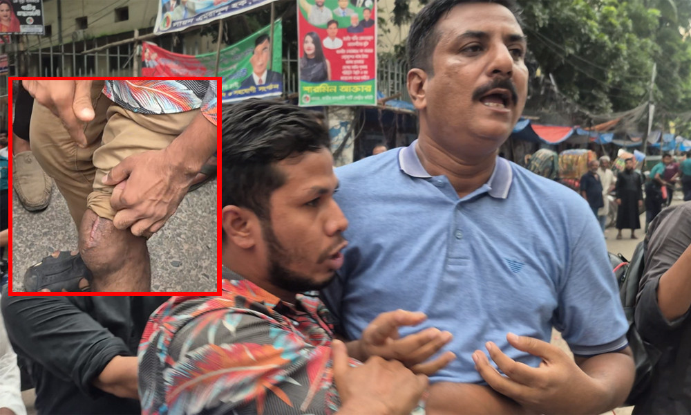 ‘উনিই আমার পায়ে ৪ আগস্ট গুলি করেছে, উনাকে আমি ছাড়ব না’ - the Bengali Times ‘উনিই আমার পায়ে ৪ আগস্ট গুলি করেছে, উনাকে আমি ছাড়ব না’ - the Bengali Times