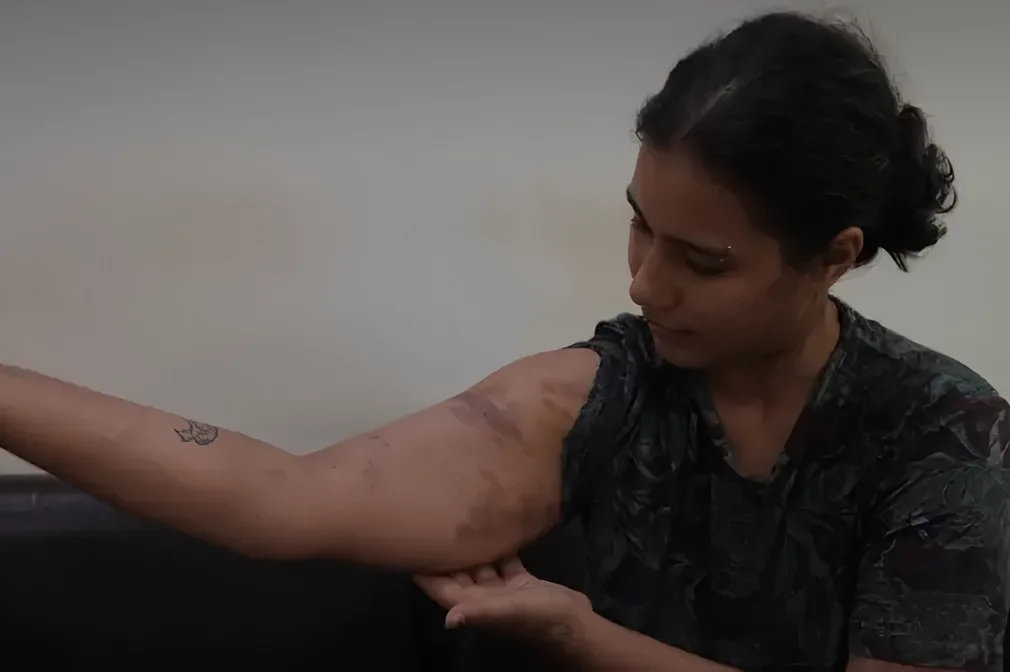 ‘যৌনাঙ্গে বুট দিয়ে মেরেছে, জামা টেনে খুলে দিয়েছে’, দিল্লিতে বিক্ষোভকারীদের অভিযোগ - the Bengali Times